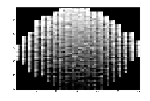 Texture Analysis of Mammographic Images 